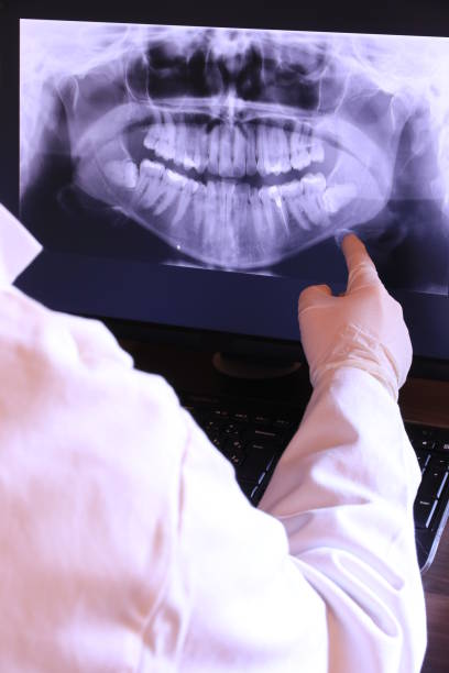 Best Broken Tooth Emergency  in Hope Mills, NC