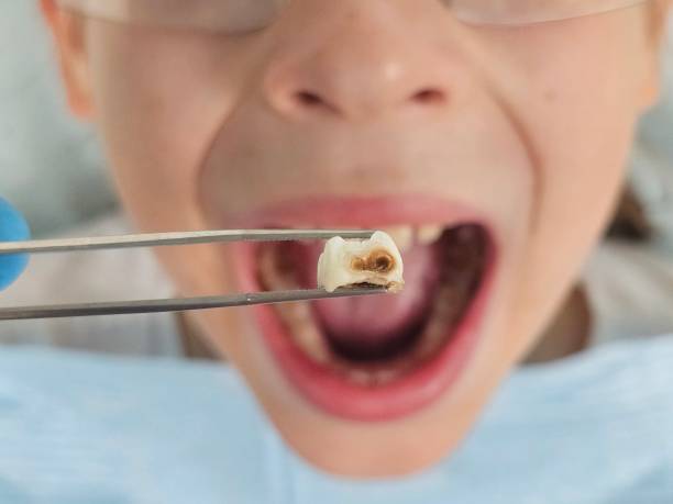 Best Broken Tooth Emergency  in Hope Mills, NC