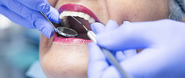 Best Dentist for Tooth Abscess  in Hope Mills, NC