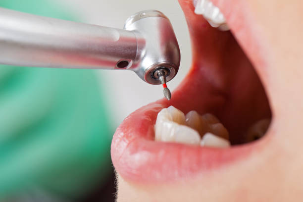  Hope Mills, NC Emergency Dentist Pros